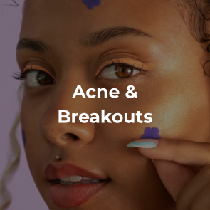 Acne & Breakouts