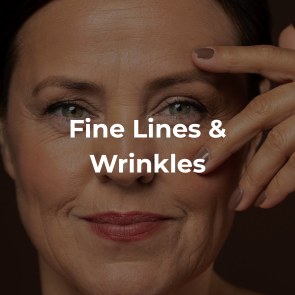 Fine Lines & Wrinkles